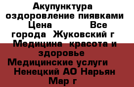 Акупунктура, оздоровление пиявками › Цена ­ 3 000 - Все города, Жуковский г. Медицина, красота и здоровье » Медицинские услуги   . Ненецкий АО,Нарьян-Мар г.